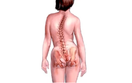 The reasons for the development of cervical osteochondrosis