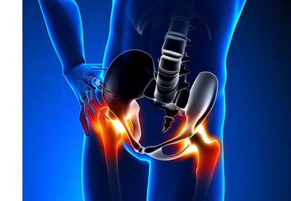 Pain for cookesartrosis