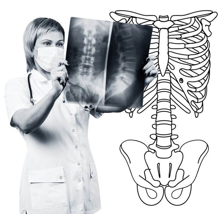 Lumbar column radiography