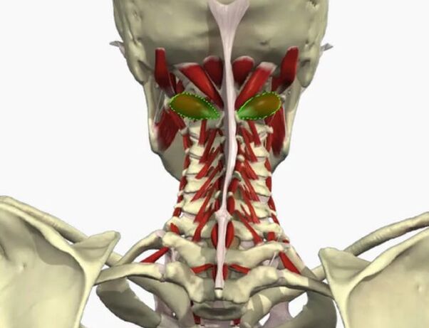 Vail artery syndrome